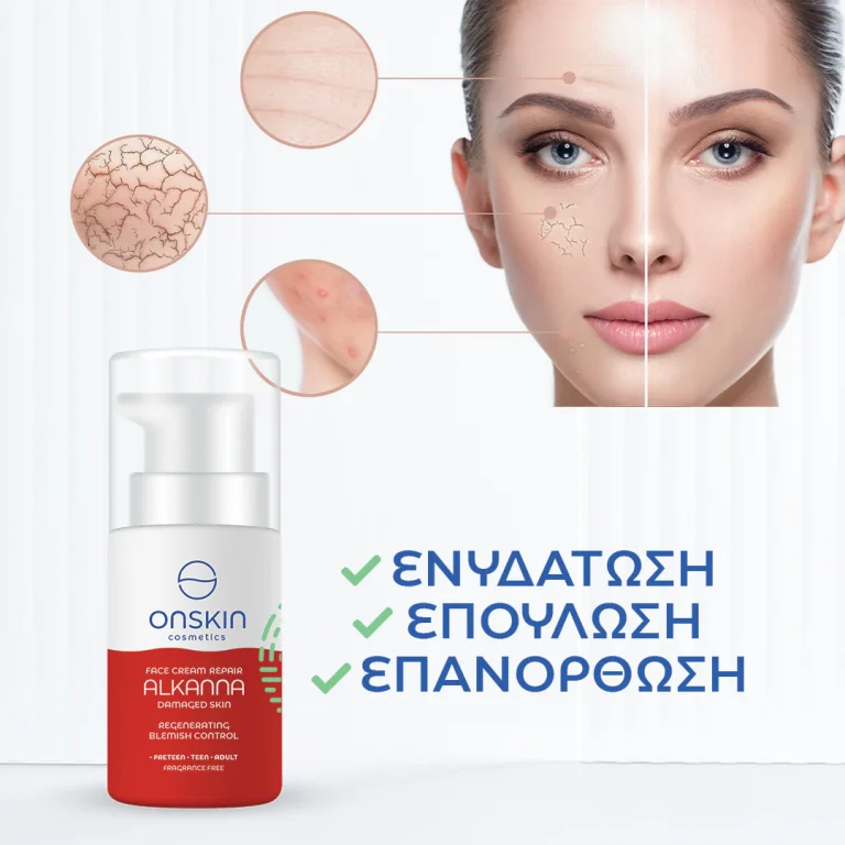 Onskin – Face Cream Repair Alkanna Damaged Skin 50ml thumbnail 3